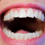 Nowoczesna technika stosowana w salonach stomatologii estetycznej być może spowodować, że odzyskamy prześliczny uśmiech.